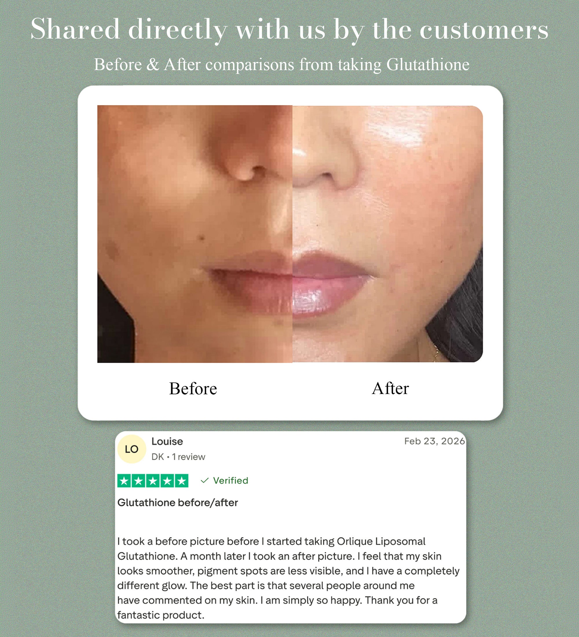 Haut- &amp; Zellschutz Liposomales Glutathion + Vitamin C | Orlique